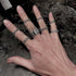 Stitches Ring